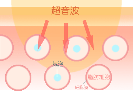 �L���r�e�[�V��������