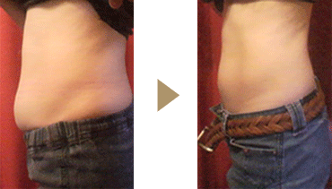 �m��F�h�z�@�Z���t���g